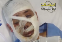 Une jeune victime de l’attaque d’un téléavertisseur israélien déclare à la télévision irakienne;l’occupation israelienne sont des terroristes depuis toujours Les milliers de bipeurs et de talkies-walkies piégés appartenant à des membres du Hezbollah, qui ont tué 37 personnes et fait près de 3 000 blessés les 17 et 18 septembre, selon un dernier bilan, ont été fabriqués et livrés au parti islamiste par des sociétés écrans créées par l’État hébreu, révèle ce jeudi 19 septembre The New York Times. Officiellement, au moins trois sociétés, dont deux fabricants asiatiques, se retrouvent au centre de cette affaire d’espionnage inédite et d’une tempête médiatique : la japonaise Icom, la taïwanaise Gold Apollo et la hongroise BAC Consulting. Si Gold Apollo a nié toute responsabilité et renvoyé la balle dans le camp de la société magyare, cette dernière a également démenti être à l’origine de la fabrication de ces appareils importés en masse par le Hezbollah il y a environ cinq mois. “Il semblerait que BAC Consulting avait signé un contrat pour produire les appareils pour le compte de Gold Apollo. En fait, elle faisait partie d’une façade israélienne”, explique le New York Times, qui a interrogé trois sources du renseignement israélien informées de l’opération. “Au moins deux autres sociétés écrans avaient également été créées pour masquer les véritables identités des personnes qui créaient ces