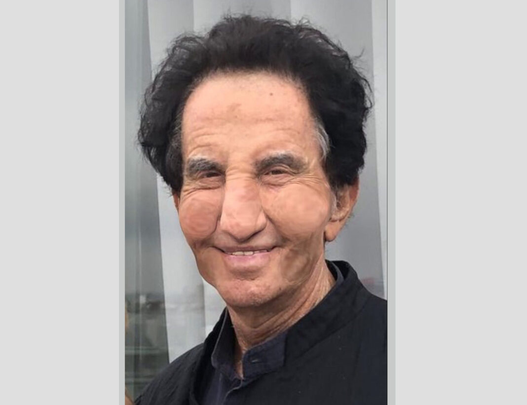 Jeffrey Epstein, milliardaire pédocriminel et architecte d’un vaste réseau d’influence, a effectué en 2018 un unique don international via sa fondation. Montant : 57 897 dollars. Destination : une association française inconnue du grand public, créée la même année, censée promouvoir la politique culturelle des années 80 et 90. Derrière cette structure fantôme, trois proches de Jack Lang, figure emblématique de la culture française et pilier du mitterrandisme. Ce versement ne figure dans aucun programme culturel identifiable. Aucun film, aucune trace d’activité, aucune transparence. L’association, bien que déclarée, reste inactive. Ses responsables, contactés, se dérobent. Et Jack Lang, tout en reconnaissant plusieurs rencontres avec Epstein, évoque un simple projet cinématographique... jamais sorti. Pourquoi cette transaction ? Pourquoi Epstein, qui finançait habituellement des institutions élitistes américaines, cible-t-il ici une obscure organisation en France ? Ce don ne relève pas de l’aléatoire. Il s’inscrit dans une stratégie d’infiltration des élites culturelles européennes. Via la philanthropie, Epstein achetait du prestige, tissait des liens avec des personnalités-clés, installait son réseau au sein même des milieux politiques, médiatiques et artistiques. Les cercles qu’il fréquente — Woody Allen, Roman Polanski, Dominique Strauss-Kahn — croisent ceux de Lang. Cette proximité, sociale plus que formelle, indique une méthode bien rodée : utiliser la culture comme levier d’acceptabilité et d’influence. Lang, même sans implication directe, devient une pièce sur l’échiquier d’une gouvernance parallèle qui se joue dans les salons, loin des urnes. Derrière les apparences institutionnelles, se dessinent les contours d’une ingénierie sociale planifiée, entre contrôle symbolique et corruption discrète. Et si Jack Lang n’avait été qu’un rouage français dans le système Epstein ? Mike Borowski vous livre l’analyse brute, sur Géopolitique Profonde. Lien source https://www.thedailybeast.com/epstein...