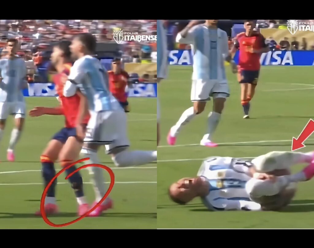 Regarde ce qui lui a fait mal : il se plaint pourtant de son genou de l'autre jambe